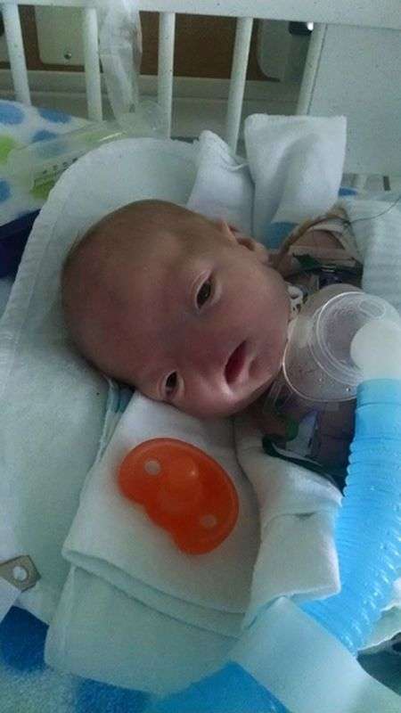 Елі Томпсон – милий 3-місячний хлопчик з відсутнім носом (12 фото)