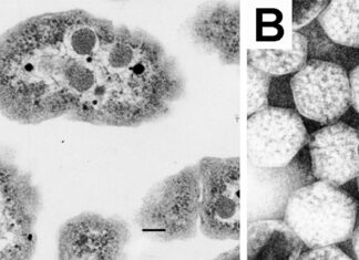 Die winzigen Kohlenstoffabscheidungsmaschinen der Natur enthüllt: Eine Blaupause für Klimainnovationen