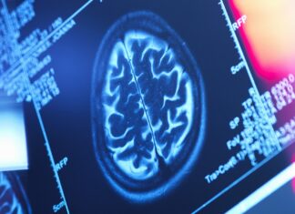 Tempat Anda Menyimpan Lemak Penting: Studi Menghubungkan Pola Lemak Tubuh dengan Penurunan Otak