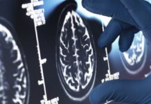 Віагра, вакцина від оперізувального лишаю та препарат від БАС визнані найкращими кандидатами для лікування хвороби Альцгеймера